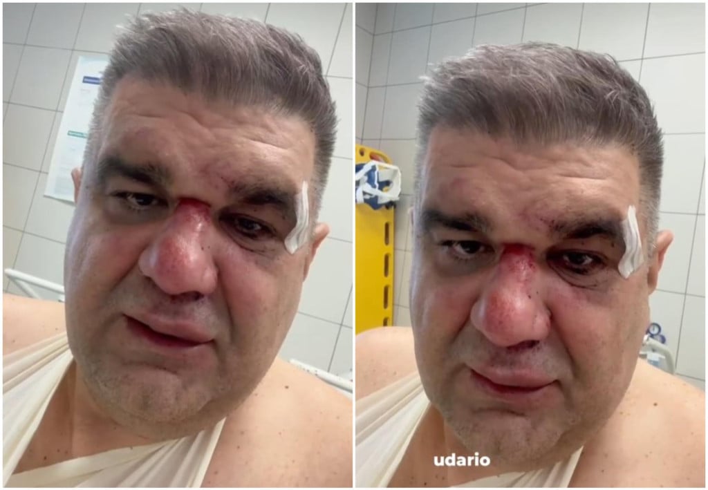 Pogledajte kako izgleda pretučeni srpski menadžer, javio se iz zagrebačke bolnice: ‘Šutirao me u glavu, a bio je s…‘ Pogledajte kako izgleda pretučeni srpski menadžer, javio se iz zagrebačke bolnice: ‘Šutirao me u glavu, a bio je s…‘
